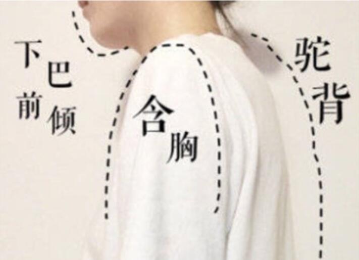 南寧美容學(xué)校：堅(jiān)持一個月，駝背變直背