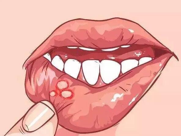 身體發(fā)出信號(hào)，你該補(bǔ)維生素了