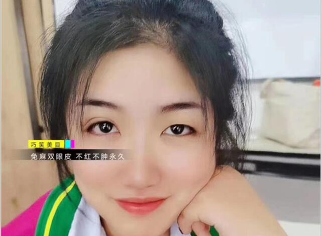 麗竹學(xué)?！凹y繡+雙眼皮”課程開講