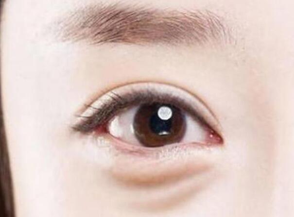 眼袋？淚溝？臥蠶？南寧美容學(xué)校教你辨別