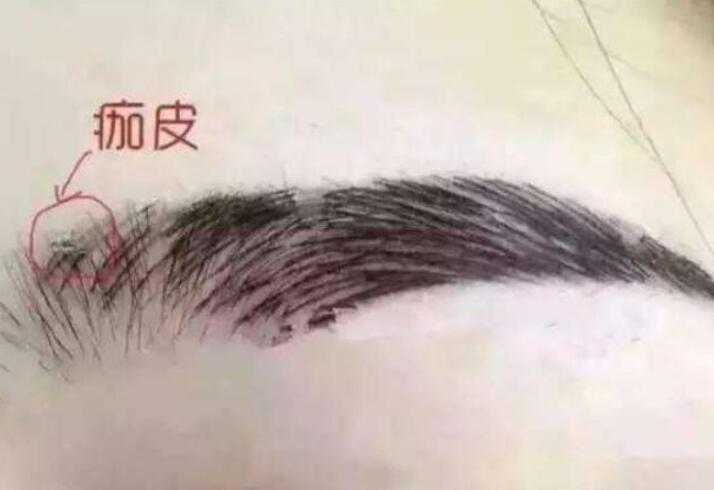 紋眉結(jié)痂時(shí)要注意什么？麗紋竹繡學(xué)校教你