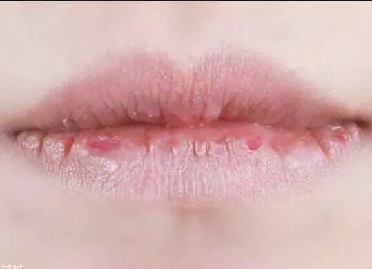 紋唇后嘴巴干燥怎么辦？南寧教紋繡的學(xué)校幫你解決