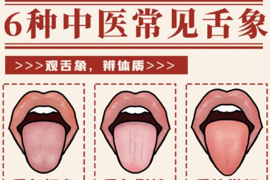 6種常見(jiàn)中醫(yī)舌診判定，快和廣西中醫(yī)美容一起學(xué)