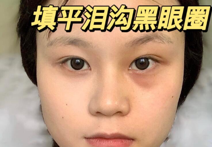 填平淚溝黑眼圈教程，廣西南寧化妝學(xué)校分享