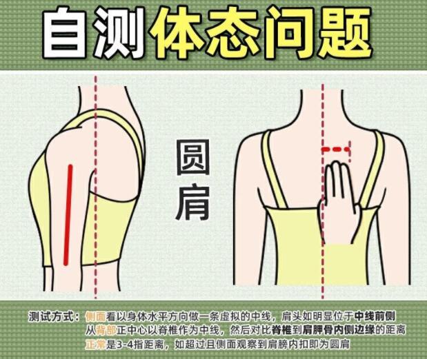 你真的是駝背嗎？廣西美容美體學校教你自測
