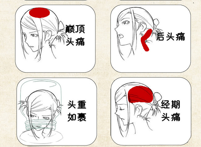不同頭痛類型經(jīng)絡護理方法，廣西中醫(yī)美容培訓