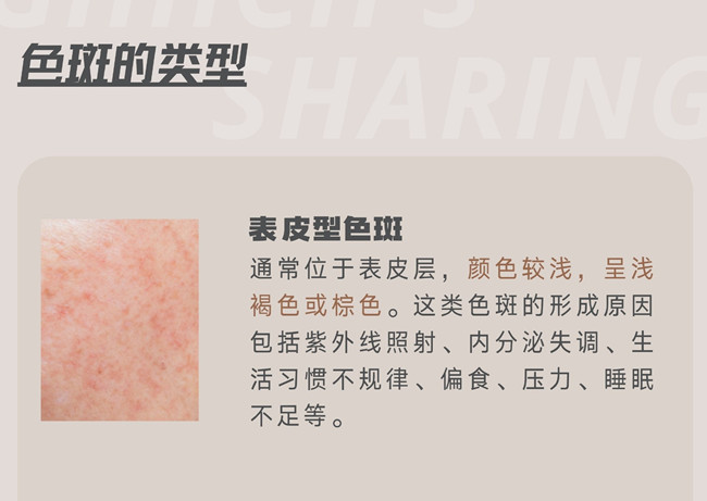 關(guān)于色斑，你需要了解這些 | 南寧皮膚管理職業(yè)學(xué)校